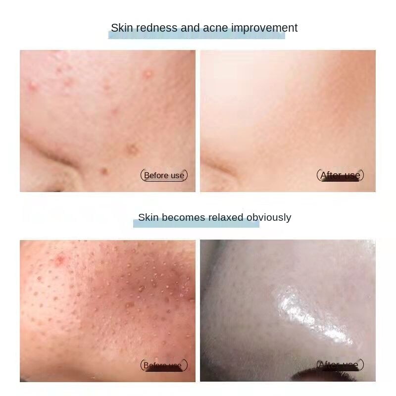 Set 8 mặt nạ HIISEES Hyaluronic Acid dưỡng ẩm làm sạch da mặt 7.5g