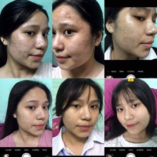 [CHÍNH HÃNG] Kem mụn thảo dược Hoa Đào