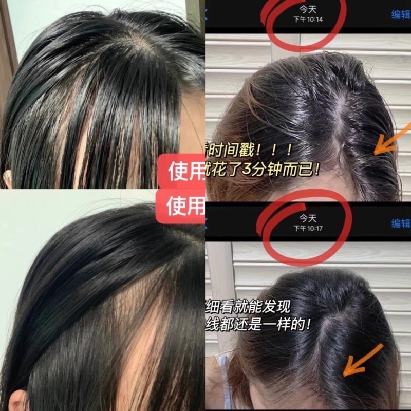Xịt Gội Đầu Khô Cấp Tốc Nội Địa Trung