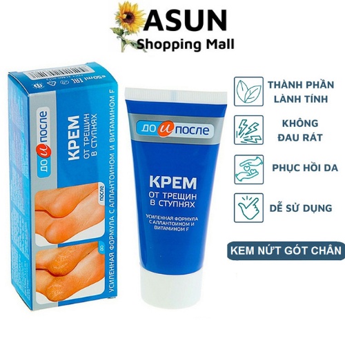 Kem Ngăn Ngừa Và Hồi Phục Nứt Nẻ Gót Chân Kpem Nga 50ml