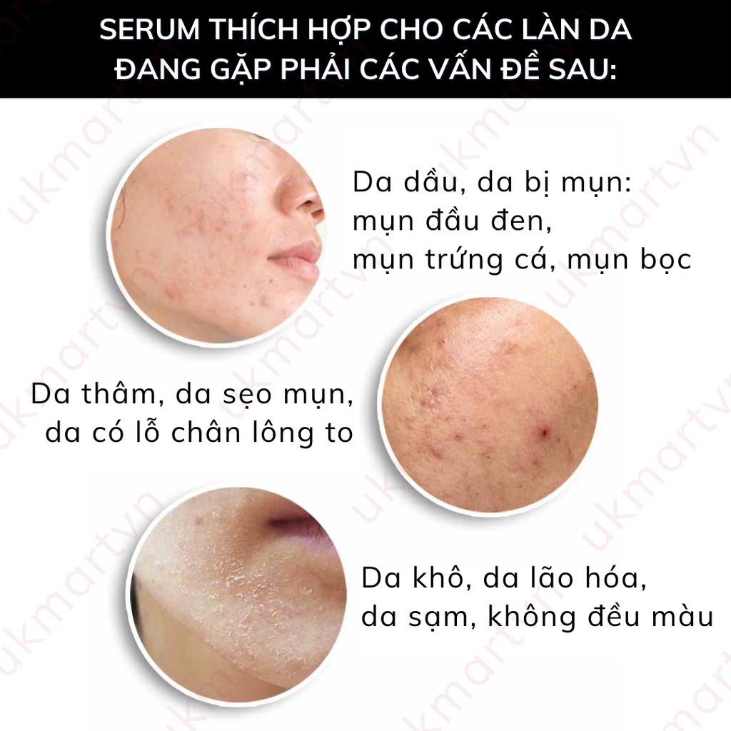 [Bill Anh] Tinh Chất The ORDINARY Niacinamide 10% + Zinc 1% 30ml