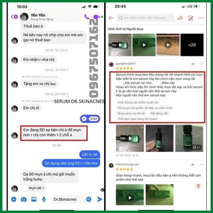 Serum Dr.Skinacnes, serum sạch mụn thâm Dr skinacnes 5ml giúp sạch bay mụn hết thâm làm mịn da hiệu quả trong 7 ngày