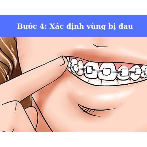 Sáp nha khoa, sáp chỉnh nha 3M, Dental Wax 3M