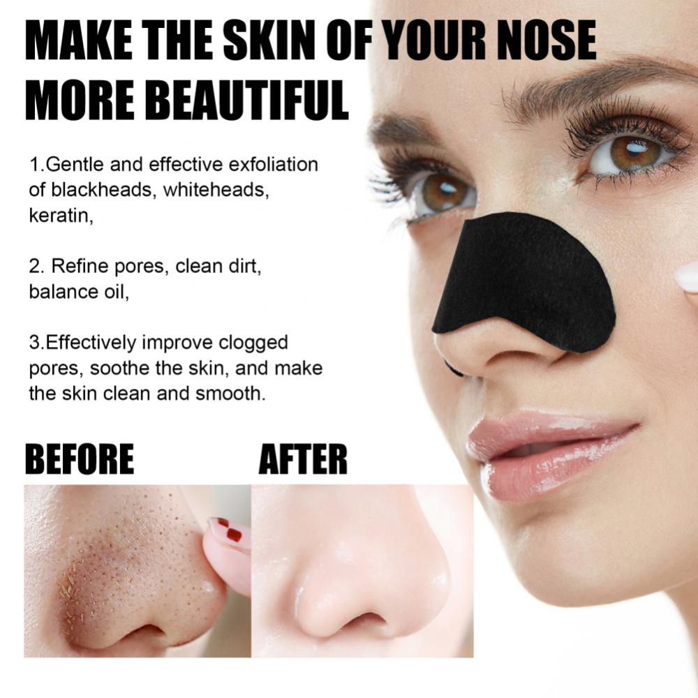 Miếng Dán Mũi Lột Mụn Đầu Đen Làm Sạch Sâu