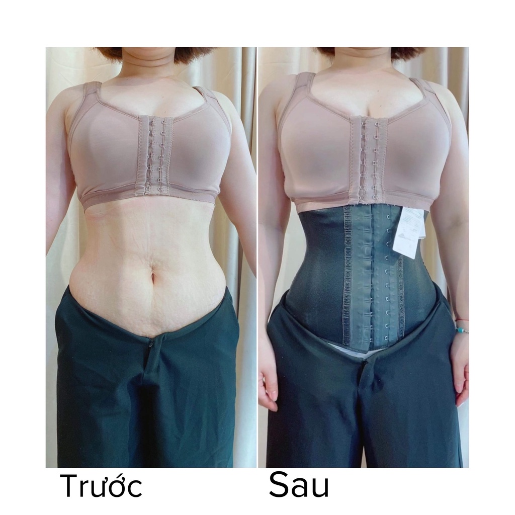 Đai nịt bụng Annchery 2038 🔥 HÀNG LOẠI 1 🔥 đai nịt bụng giúp thu gọn vùng bụng, tạo độ cong cho eo | BigBuy360 - bigbuy360.vn