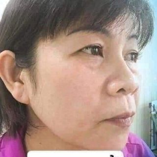 Kem face pháp