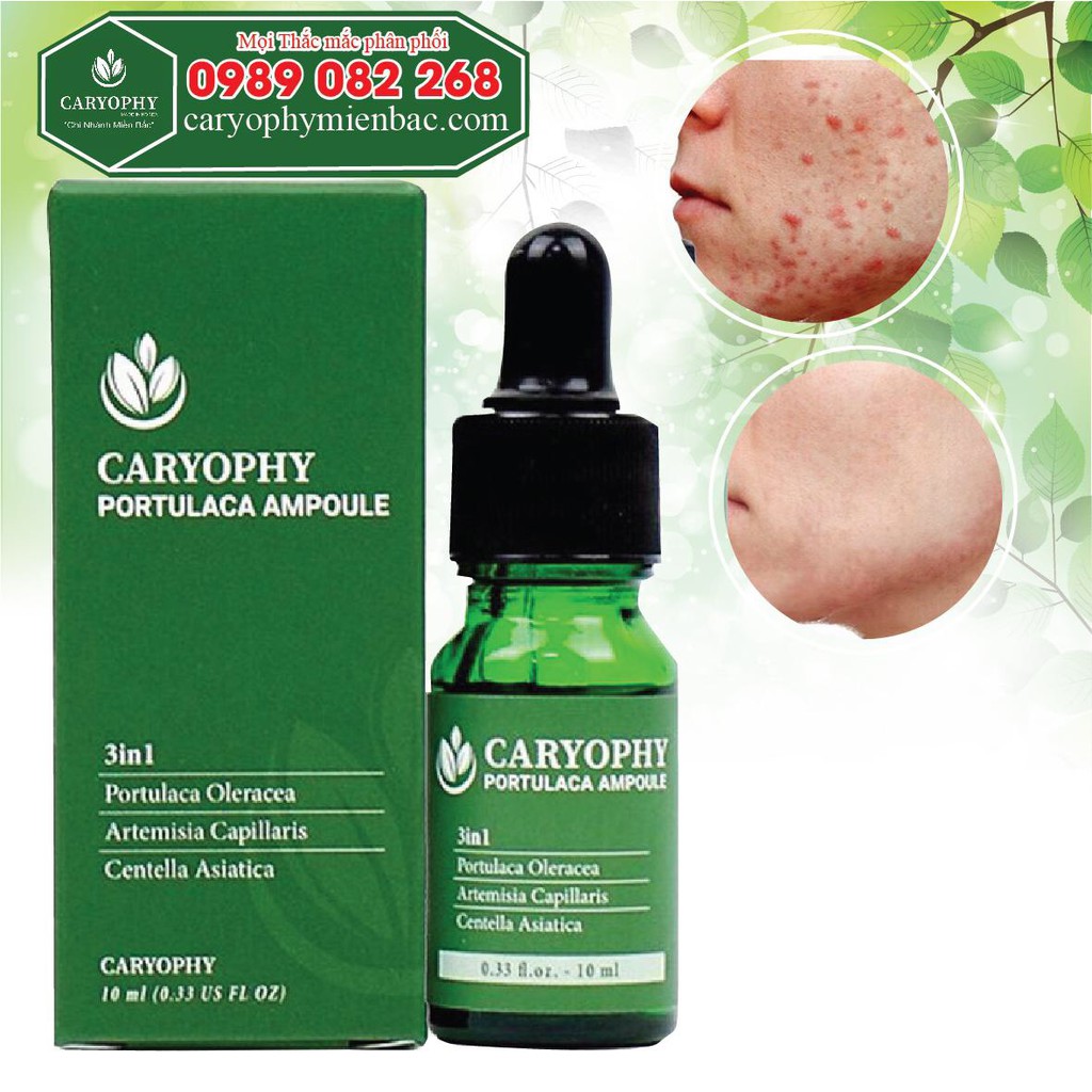 Combo Sữa Rửa Mặt + Serum Ngăn Ngừa Mụn Thâm Caryophy❤️FREESHIP❤️Ngăn Ngừa Các Loại Mụn và Thâm chính hãng Hàn Quốc | BigBuy360 - bigbuy360.vn