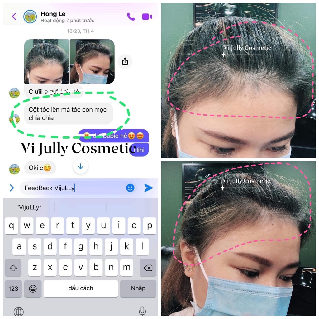 [DÀI TÓC SIÊU NHANH] Combo 5 Chai Tinh Dầu Bưởi Vi Jully Cosmetic Kích Mọc Tóc  Giảm Rụng Tóc- TIẾT KIỆM 25%