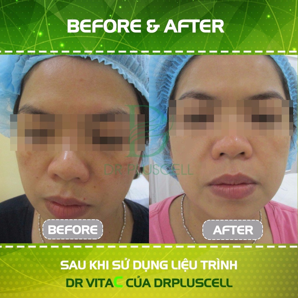 Tế bào gốc nám, trắng sáng Dr Pluscell_ Dr vita c Dr Pluscell