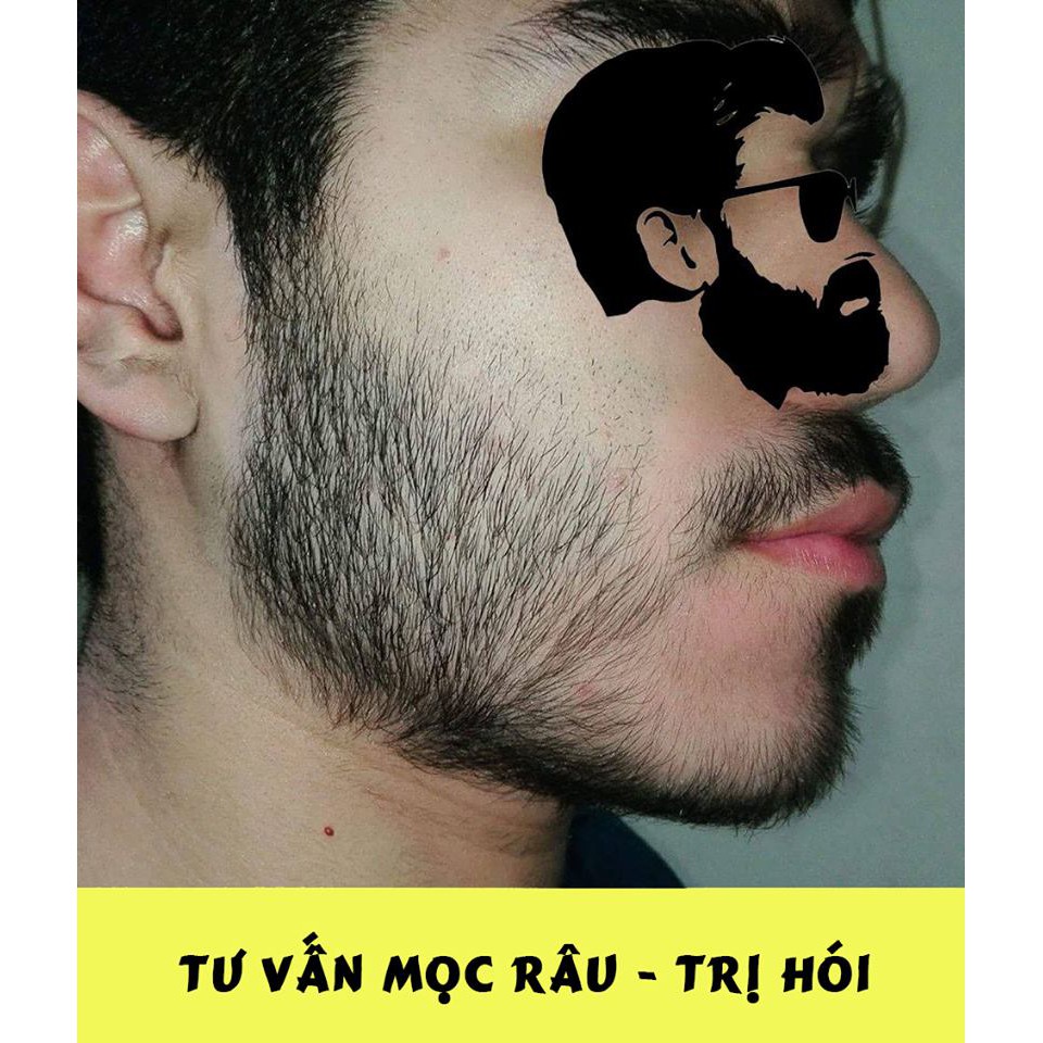 Dầu Dưỡng Râu - Chống Khô Da Khi Dùng Minoxidil 5% | BigBuy360 - bigbuy360.vn