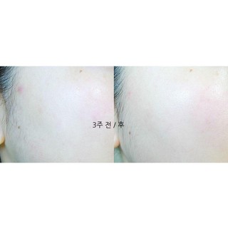 Serum AMPLE:N HyaluronShot Ampoule