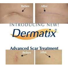 DERMATRIX GEL 7Gr Hỗ Trợ Lành Sẹo