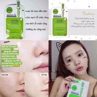 Mặt nạ Mediheal Tea Tree Care Solution Essential Mask Ex