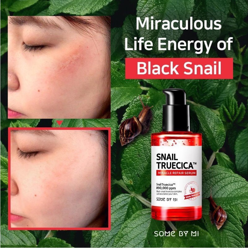 Tinh Chất Ốc Sên Đen Cải Thiện Sẹo Lõm - Sẹo Mụn Some By Mi Snail Truecica Miracle 50ml