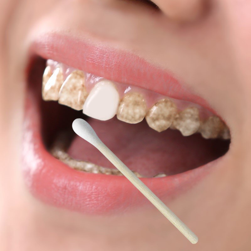 Bút Gel Làm Trắng Răng Loại Bỏ Vết Bẩn Chất Lượng Cao