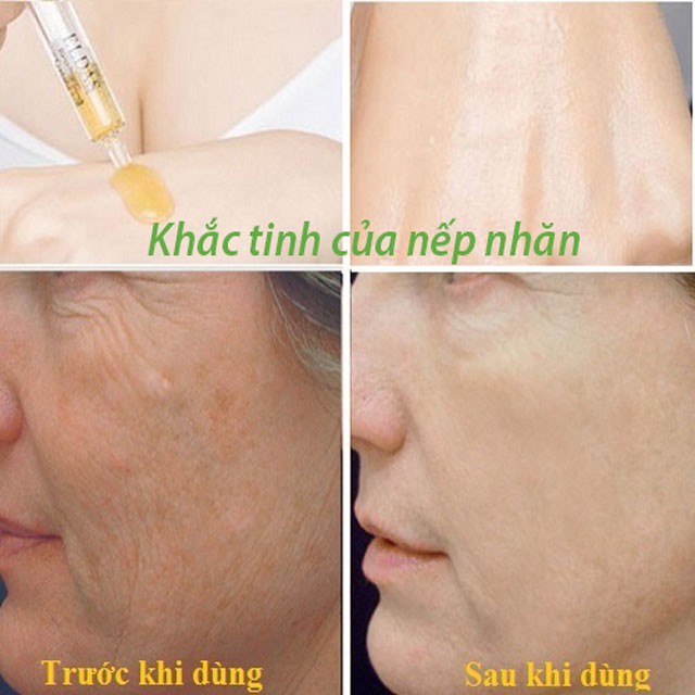 [CHÍNH HÃNG] Tinh chất tế bào gốc ELDAS tái tạo và trẻ hóa làn da, khắc tinh của nếp nhăn