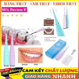 Máy Lấy Cao Răng Cầm Tay Mini 3 Chế Độ Rung Loại Sạch Mảng Bám Cao Răng Vết Ố Cứng Đầu Nhất