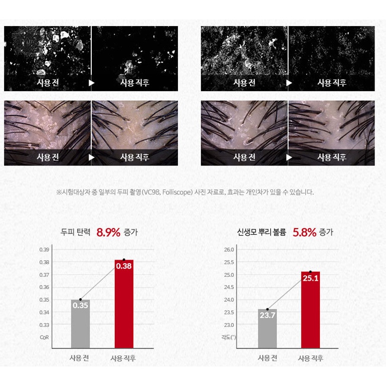 Dầu gội giảm rụng tóc Dr.FORHAIR Folligen Original/ 닥터포헤어 폴리젠 샴푸