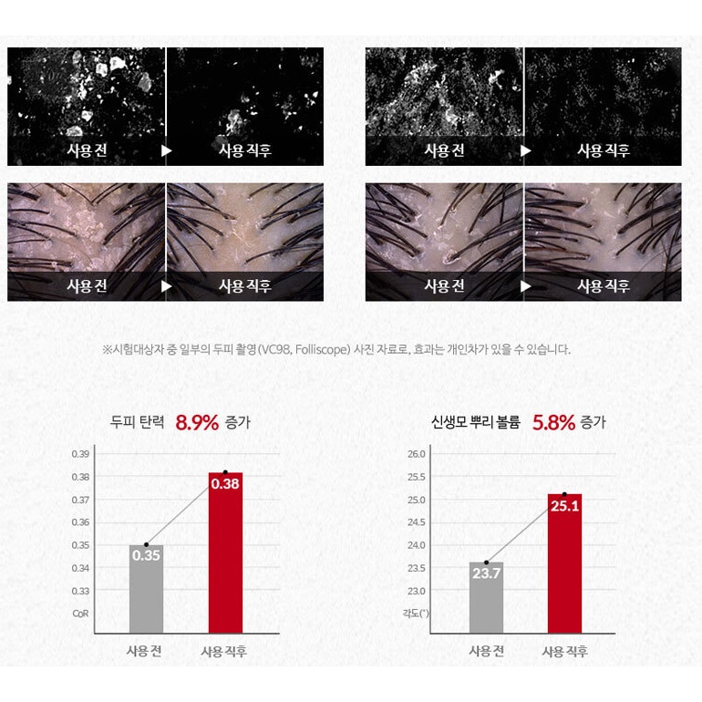 [Chính hãng] Dầu gội giảm rụng tóc Dr.FORHAIR Folligen Original/ 닥터포헤어 폴리젠 샴푸 (탈모완화)