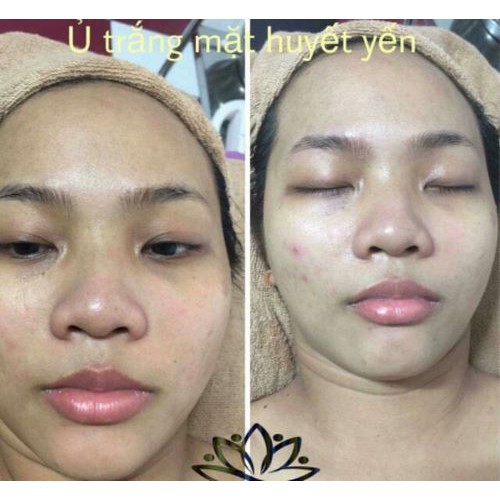 Ủ trắng huyết yến collagen - Freeship toàn quốc | BigBuy360 - bigbuy360.vn