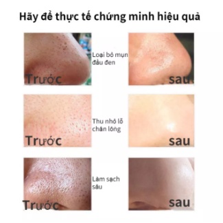 Mặt nạ mặt nạ dưỡng trắng da lột mụn đầu đen 50ML Làm sạch sâu da loại bỏ mụn đầu đen làm trắng da mặt
