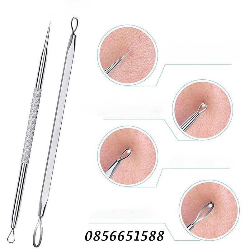 Bộ dụng cụ nặn mụn Inox cao cấp