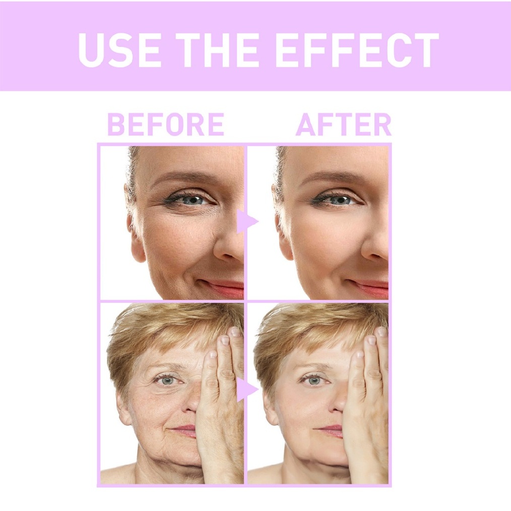 [Hàng mới về] Serum botox làm săn chắc giảm nếp nhăn lão hóa da mặt 10ml