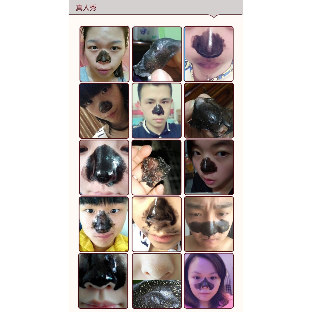 Set Hộp Lột Mụn 3 Bước Bioaqua An Toàn Cho Da Đánh Bay Các Loại Mụn | BigBuy360 - bigbuy360.vn