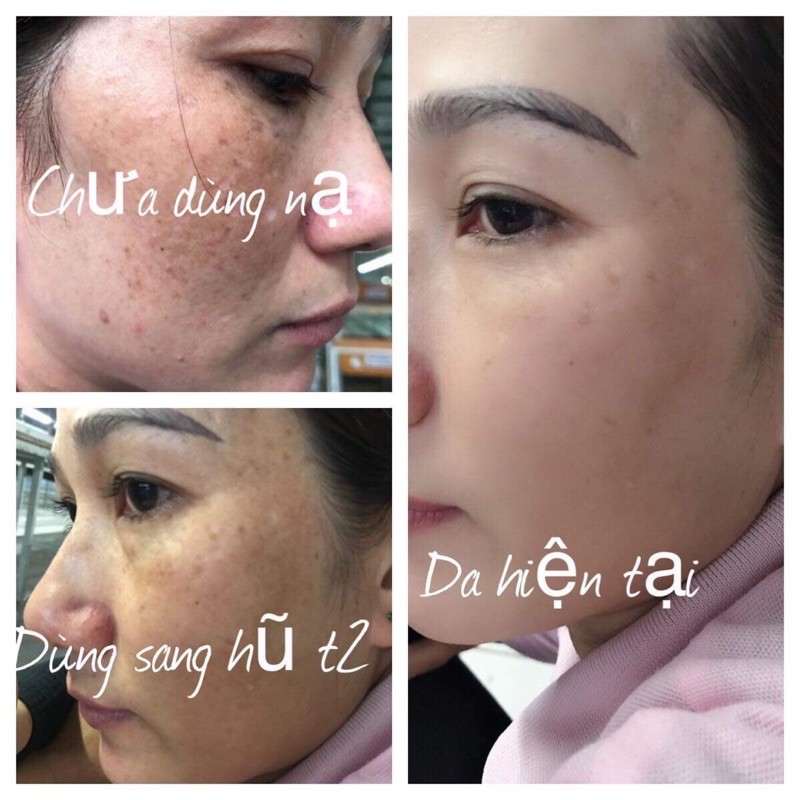 Mặt Nạ Ngủ Tổ Yến Collagen Dành Cho Da Nám Mụn