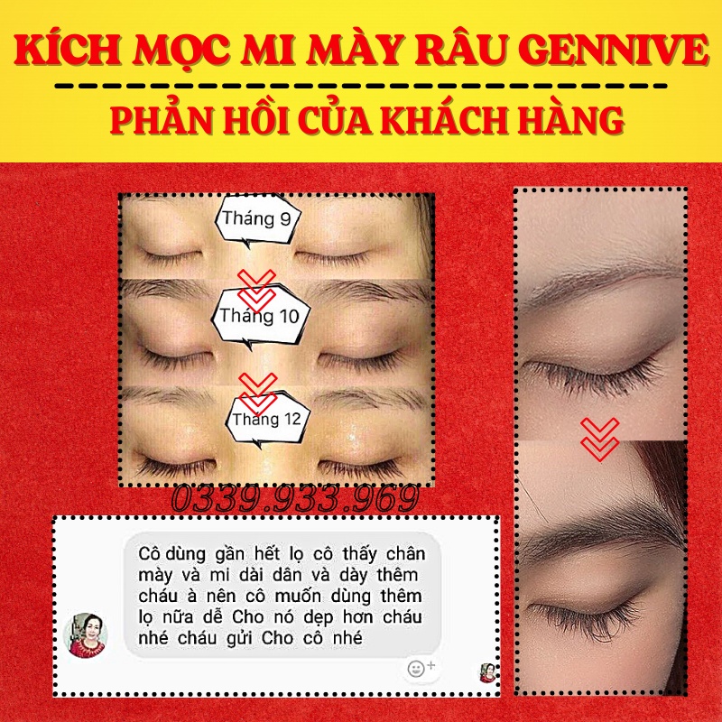 (HOT) Serum Mọc Dày Mi, Lông Mày, Râu Genive