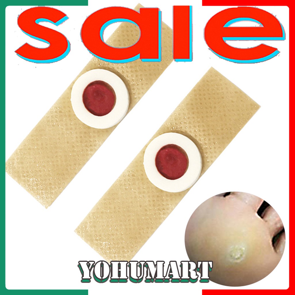 (Hàng Mới Về) Bộ 42 Miếng Dán Trị Mụn Cóc Chất Lượng Cao