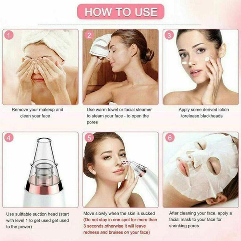[Hàng mới về] Máy hút mụn đầu đen chất lượng cao