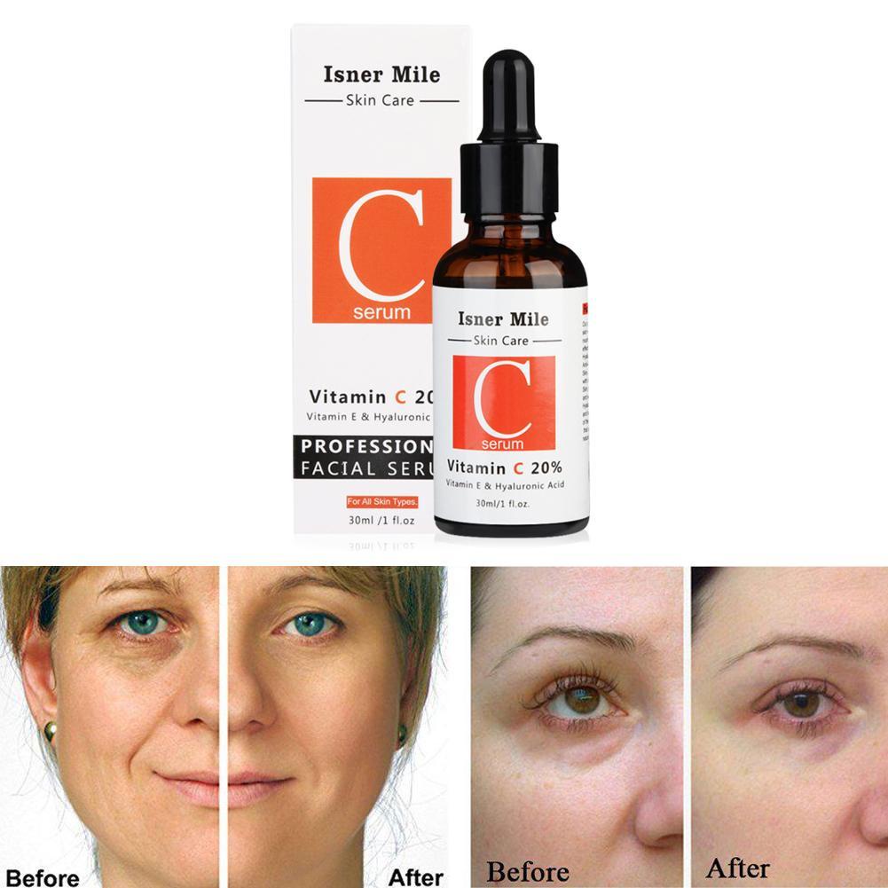Tinh Chất Hyaluronic Acid ISNER MILEC Hyaluronic Acid Chăm Sóc Da Mặt Sodium L-vitamin Vserum I6C0