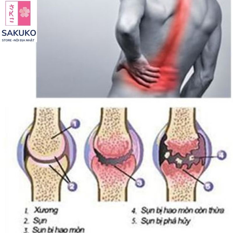 Viên uống hỗ trợ xương khớp nhện Zs Chondroitin Nhật Bản 270 Viên