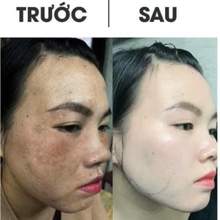 Kem Collagen plus vit e Malaysia