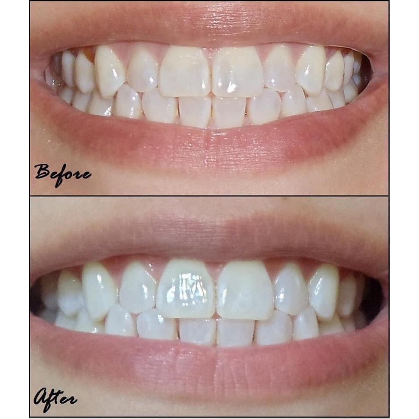 Kem Đánh Răng MEDIAN Dental IQ 120g