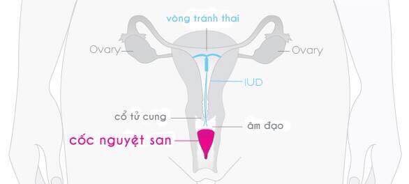 Cốc nguyệt san Lincup chính hãng Mỹ