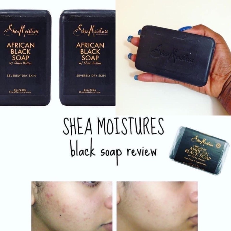 Xà phòng SheaMoisture African Black Soap Bar Soap