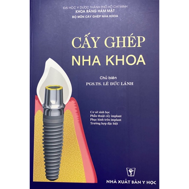 Sách - Cấy ghép nha khoa