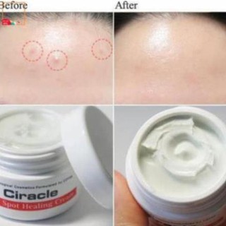 Kem Trị Mụn Ciracle Red Spot Healing Cream