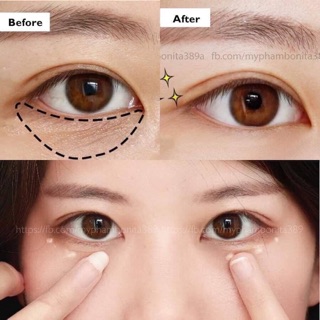 ☀️Kem Mắt  🍀ELIXIR SHISEIDO 🍀 15g