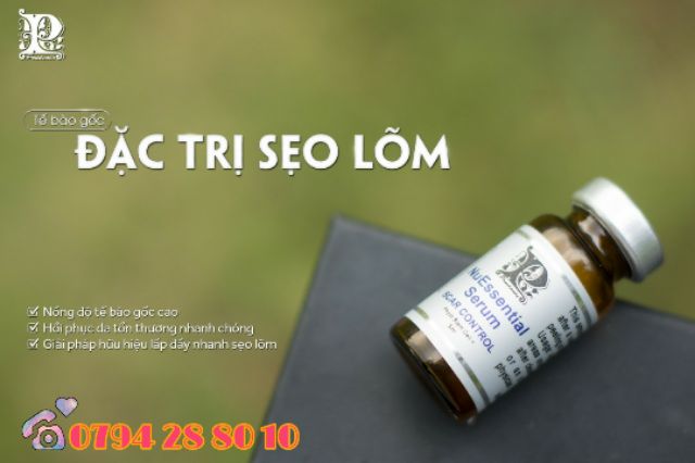 Tế bào gốc Mibiti Prudente Scar Control - đặc trị sẹo lõm