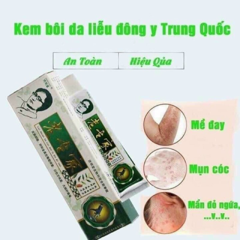 Kem thảo dược bôi ngoài da nứt nẻ nấm ngứa vảy nến á sừng hiệu quả nhanh chóng chính hãng