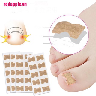 (Hàng Mới Về) Set 10 Dụng Cụ Chỉnh Hình Móng Chân Mọc Ngược Tiện Dụng