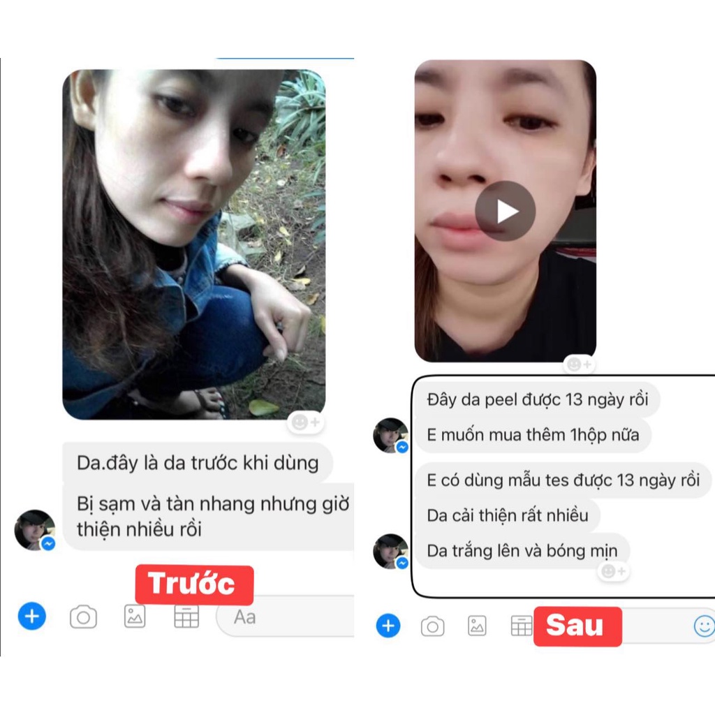 White Peeling Beauty Cream - Nicos Thanh Nhi