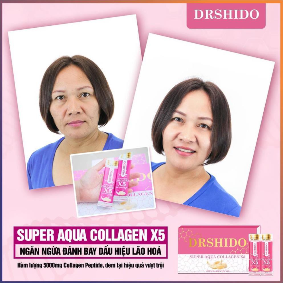 Supper aqua collagen X5 chính hãng - Nước collagen Yến Sào -  Loại 14 gói