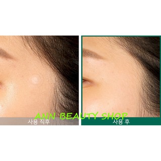 Miếng Dán Mụn Some By Mi Clear Spot Patch