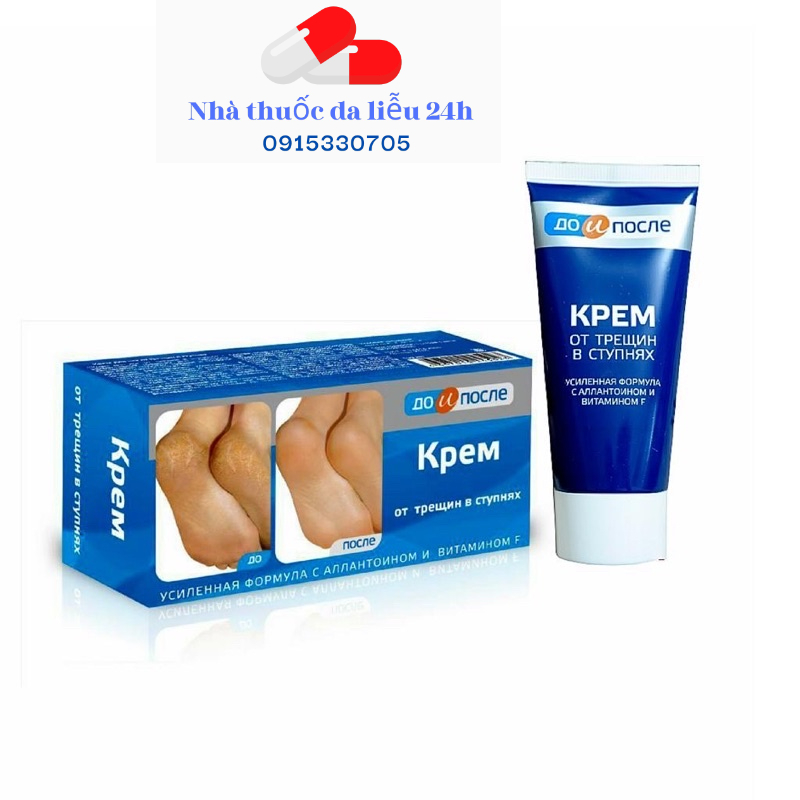 Kem bôi nẻ, nứt gót chân, dưỡng mềm mịn gót chân Kpem Nga 50ml - Nhà Thuốc Da Liễu 24h