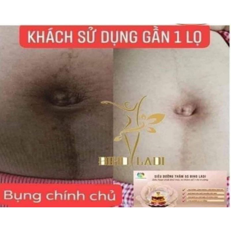 [CHÍNH HÃNG] SIÊU DƯỠNG THÂM 5S BIHO LADI | BigBuy360 - bigbuy360.vn