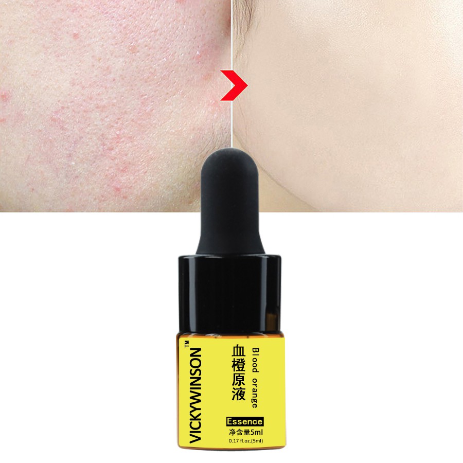 Tinh Chất Cam Máu 5ml Chống Oxy Hóa Làm Trắng Da Tự Nhiên